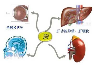 人体麻豆视频三级片数据能够准检测出但身体中微量元素铜超标会引起疾病发生 人体麻豆视频三级片数据能够准检测出但身体中微量元素铜超标会引起疾病发生